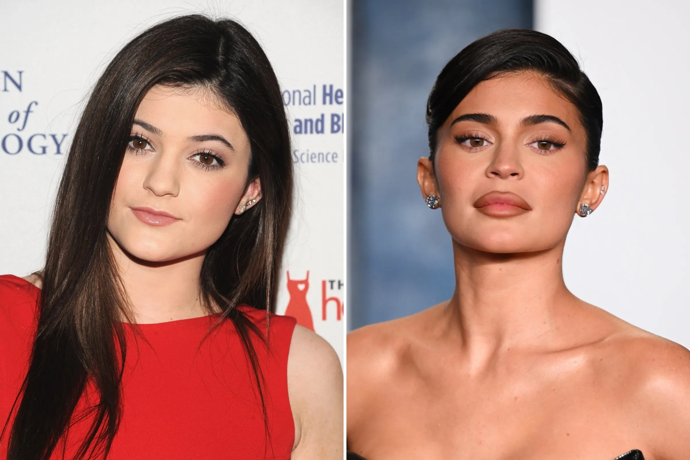 Kylie Jenner's Plastic Surgery Comments Spark Jokes, Memes - Newsweek